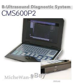 Portable Laptop Machine Digital Ultrasound Scanner, 3.5M Convex+Cardiac 2 Probes