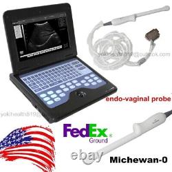 Portable Laptop Machine Digital Ultrasound Scanner 6.5Mhz Transvaginal Probe USA