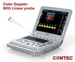 Portable Laptop Machine Digital Ultrasound Scanner Color Doppler + Linear Probe