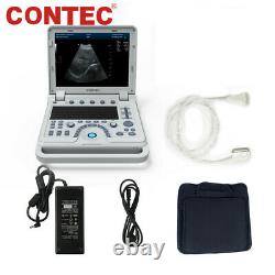 Portable Laptop Machine Digital Ultrasound Scanner Color Doppler + Linear Probe