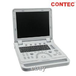 Portable Laptop Machine Digital Ultrasound Scanner Color Doppler + Linear Probe