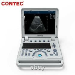 Portable Laptop Machine Digital Ultrasound Scanner Color Doppler + Linear Probe