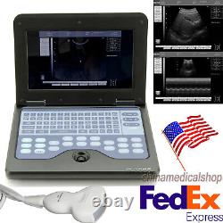 Portable Laptop Machine Digital Ultrasound Scanner Convex/Abdominal Probe CE&FDA
