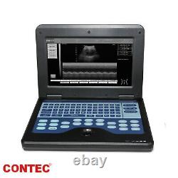Portable Laptop Machine Digital Ultrasound Scanner, Convex+Linear+Cardiac Probes