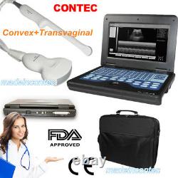 Portable Laptop Machine Digital Ultrasound Scanner Convex, Transvaginal Probe USA