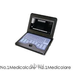 Portable Laptop Machine Digital Ultrasound Scanner Convex+transvaginal 2 Probes