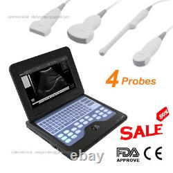 Portable Laptop Ultrasound Scanner + Convex/Linear/Cardiac/Transvaginal 4 probes