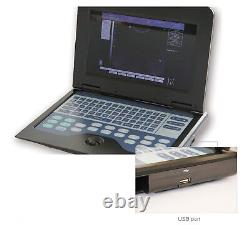 Portable Laptop Ultrasound Scanner + Convex/Linear/Cardiac/Transvaginal 4 probes