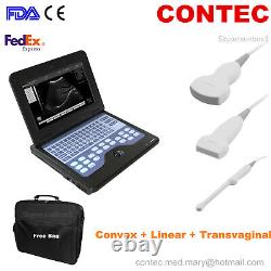Portable Laptop Ultrasound Scanner Digital Machine 3 Probes Human CONTEC FDA CE