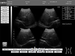Portable Laptop Ultrasound Scanner Digital Machine 4 Probes Human CONTEC FDA CE