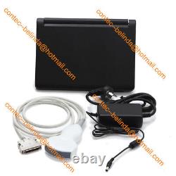 Portable Laptop Ultrasound Scanner Machine Diagnostic System 3.5Mhz Convex Probe