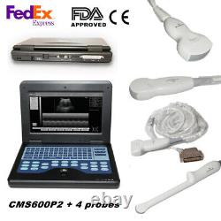 Portable Medical Diagnostic Ultrasound Scanner Device Convex Linear 4 Probes FDA