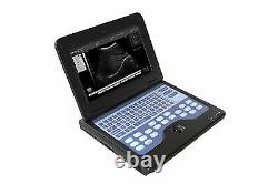 Portable Notebook Laptop Ultrasound machine Scanner, 3.5MHZ CONVEX probe, cart