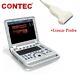 Portable Ultrasound Scanner 15 Laptop Machine W Linear Probe Pw Pulse Doppler