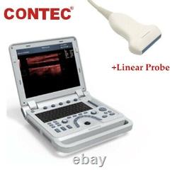 Portable Ultrasound Scanner 15 Laptop Machine w Linear Probe PW Pulse doppler