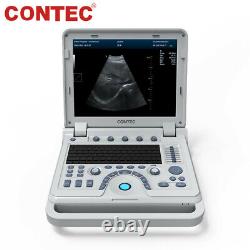 Portable Ultrasound Scanner 15 Laptop Machine w Linear Probe PW Pulse doppler