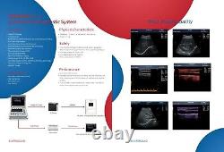 Portable Ultrasound Scanner 15 Laptop Machine w Linear Probe PW Pulse doppler