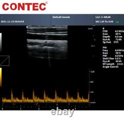 Portable Ultrasound Scanner 15 Laptop Machine w Linear Probe PW Pulse doppler