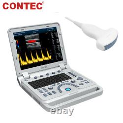 Portable Ultrasound Scanner Color Doppler Diagnostic System Machine+Convex Probe