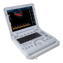 Portable Ultrasound Scanner Color Doppler Diagnostic System Machine+Convex Probe