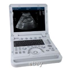 Portable Ultrasound Scanner Color Doppler Diagnostic System Machine+Convex Probe