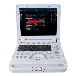 Portable Ultrasound Scanner Color Doppler Diagnostic System Machine+Convex Probe