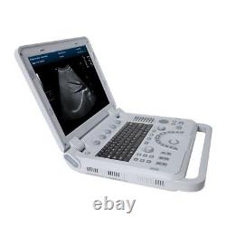 Portable Ultrasound Scanner Color Doppler Diagnostic System Machine+Convex Probe