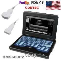 Portable Ultrasound Scanner Diagnostic Device Machine Convex / Linear 2 Probes