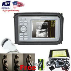 Portable Ultrasound Scanner Digital Convex/Abdomen Probe For Human USE