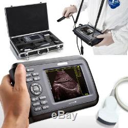 Portable Ultrasound Scanner Digital Convex/Abdomen Probe Human 3D Machine US