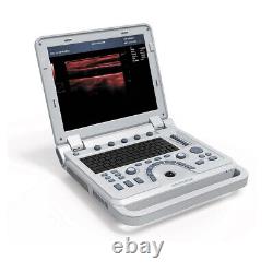 Portable Ultrasound Scanner Laptop Machine 7.5 Linear probe, pseudo Color Doppler