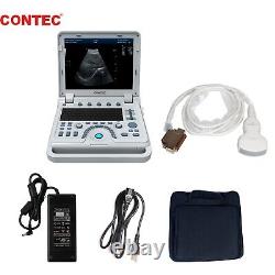 Portable Ultrasound Scanner Laptop Machine Diagnostic Convex Probe CMS600P2 PLUS