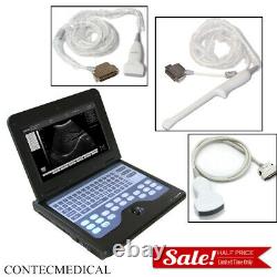 Portable Ultrasound Scanner Machine+Convex +Linear +Transvaginal 3 Probes CE FDA