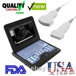 Portable Ultrasound Scanner Machine Diagnostic System+Convex Probe+Linear Probe