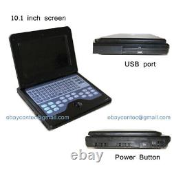 Portable Ultrasound Scanner Machine Diagnostic System+Convex Probe+Linear Probe