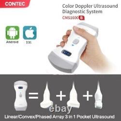 Portable Ultrasound Scanner Machine Wireless 3 In 1 Dual head Color Doppler, App