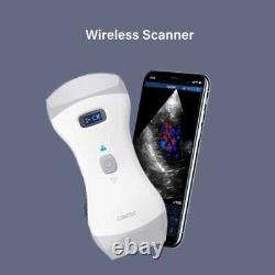 Portable Ultrasound Scanner Machine Wireless 3 In 1 Dual head Color Doppler, App