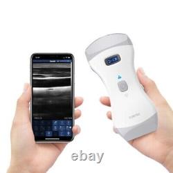 Portable Ultrasound Scanner Machine Wireless 3 In 1 Dual head Color Doppler, App