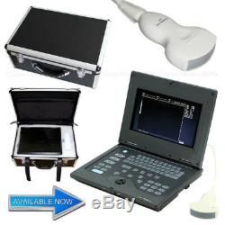 Portable Ultrasound Scanner Notebook Laptop Scanner Machine 3.5Mhz Convex Probe