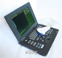 Portable Ultrasound Scanner Notebook Laptop Scanner Machine 3.5Mhz Convex Probe