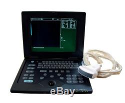 Portable Ultrasound Scanner Notebook Laptop Scanner Machine 3.5Mhz Convex Probe