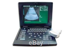 Portable Ultrasound Scanner Notebook Laptop Scanner Machine 3.5Mhz Convex Probe