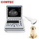 Portable Veterinary Color Doppler Ultrasound Scanner Machine Dog Pets Vet Convex