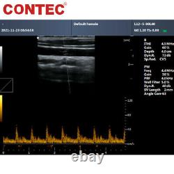 Portable Veterinary Ultrasound Scanner Laptop Convex Probe PW Pulse Wave Doppler