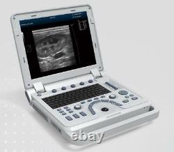 Portable Veterinary Ultrasound Scanner Pulse Wave Doppler Machine +Convex Probe