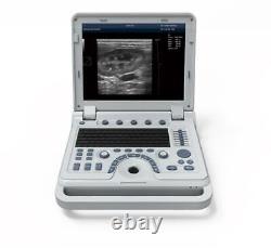 Portable Veterinary Ultrasound Scanner Pulse Wave Doppler Machine +Convex Probe