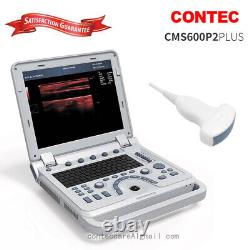 Portable laptop Digital B-Ultrasound machine Scanner+3.5Mhz convex Probe, CONTEC