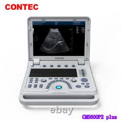 Portable laptop Digital B-Ultrasound machine Scanner+3.5Mhz convex Probe, CONTEC