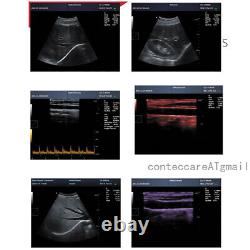 Portable laptop Digital B-Ultrasound machine Scanner+3.5Mhz convex Probe, CONTEC