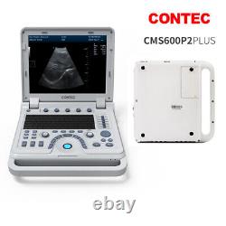 Portable laptop Digital B-Ultrasound machine Scanner+3.5Mhz convex Probe, CONTEC